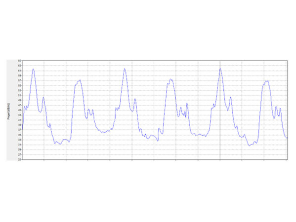 Diagram 3: Opening and closing of the car and landing doors at the landing. Photo: © Ulrich Nees / Jan König Diagram 3: Opening and closing of the car and landing doors at the landing. Photo: © Ulrich Nees / Jan König